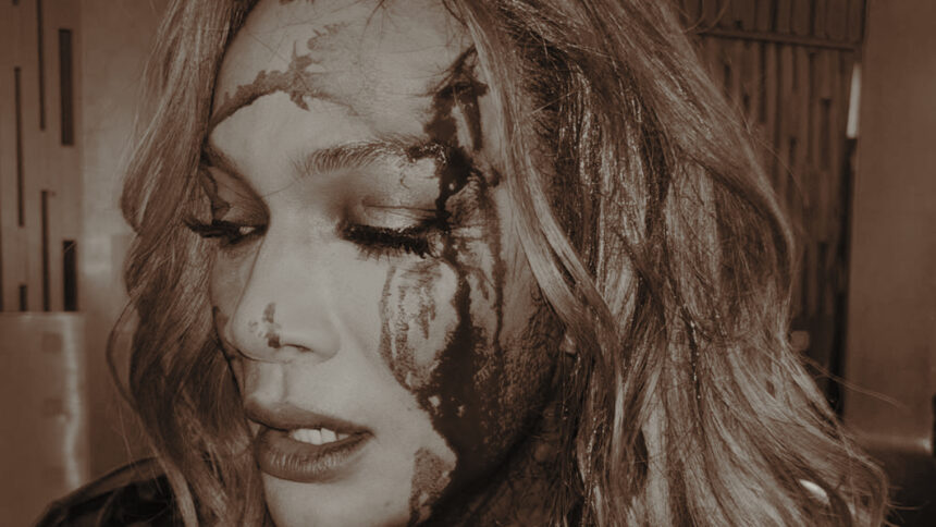 Nia Jax shares bloody wounds after Smackdown, Superstar reacts