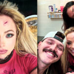 Liv Morgan displays battle scars following money in bank qualifiers