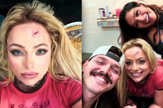 Liv Morgan displays battle scars following money in bank qualifiers
