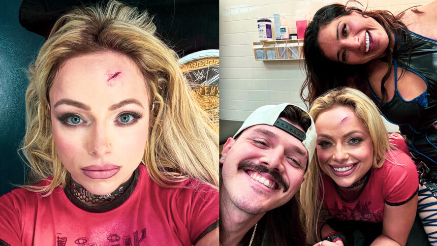 Liv Morgan displays battle scars following money in bank qualifiers