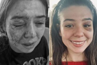 Eddie Guerrero's daughter Kaylie reveals great progress in healing dog bite