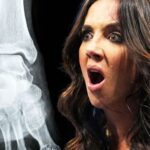 Chelsea Green's ankle injury was much more serious than expected