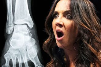 Chelsea Green's ankle injury was much more serious than expected